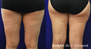 BodyFX: Before And After 