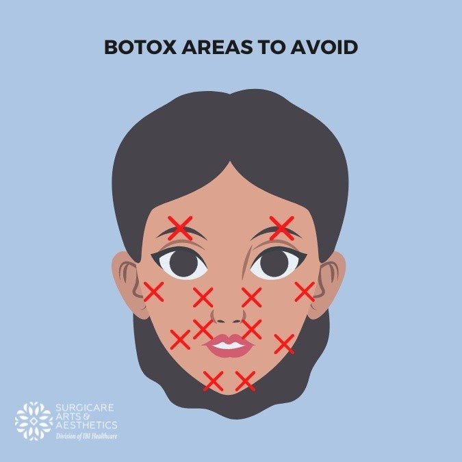 Illustration: Botox areas to avoid