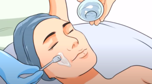 Chemical Peels Benefits in Atlanta