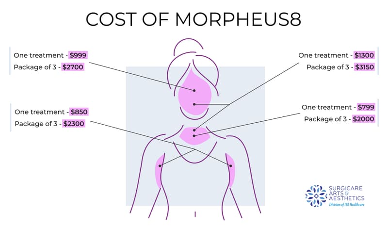 Cost of Morpheus8
