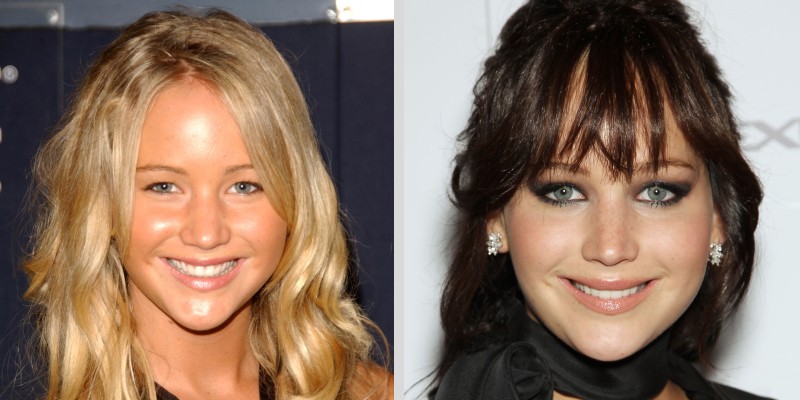 Jennifer Lawrence before and after eyelid surgery