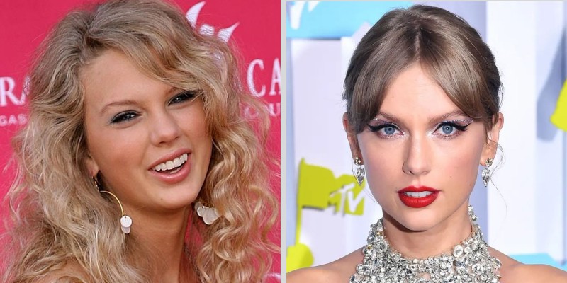 Taylor Swift blepharoplasty before and after