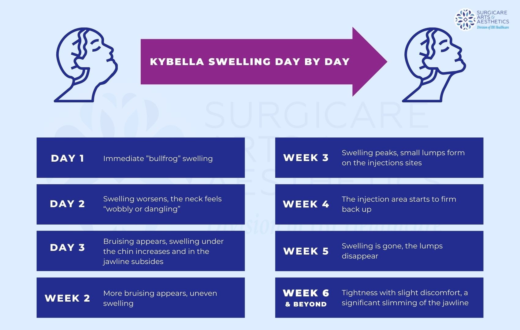 Kybella Swelling Day By Day and week by week