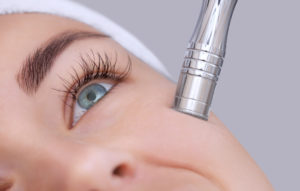 Microdermabrasion, IBI Plastic Surgery & Med Spa & Aethetics, Atlanta, GA