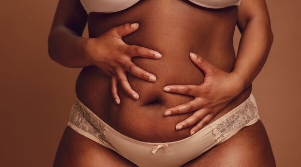 What Is The Effect of a Plus-Size Tummy Tuck And a BBL?