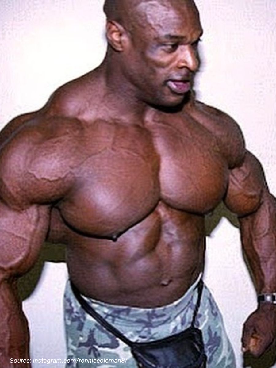 Ronnie Coleman gynecomastia