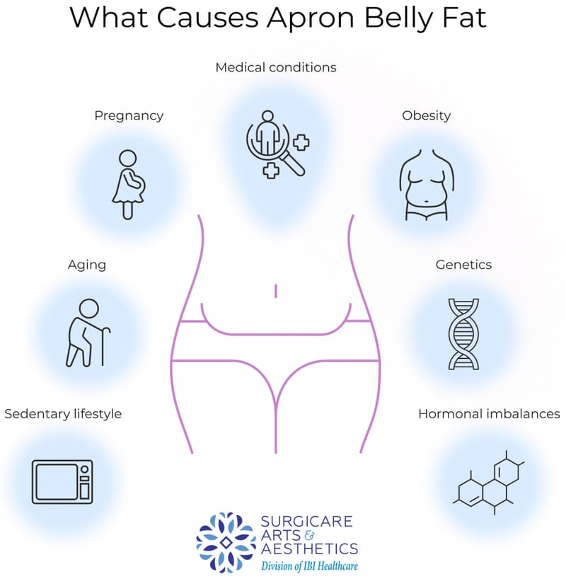 What Causes An Apron Belly And How To Get Rid Of It