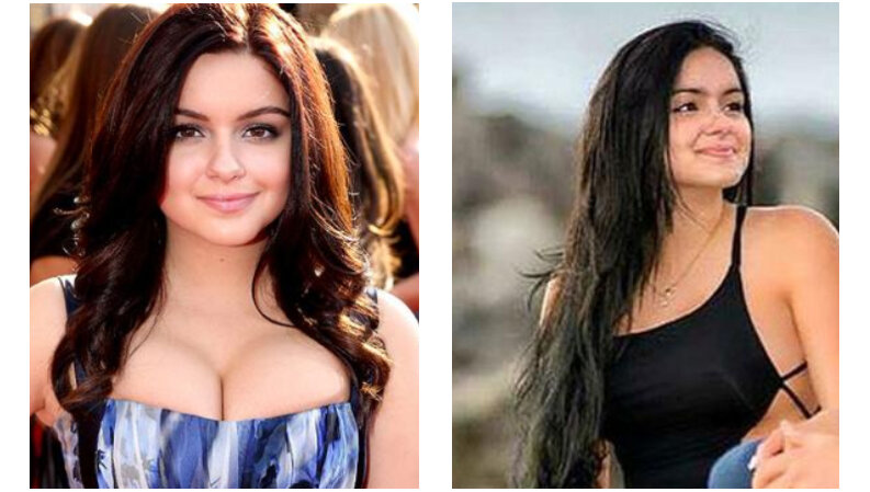 Ariel Winter before and after breast reduction