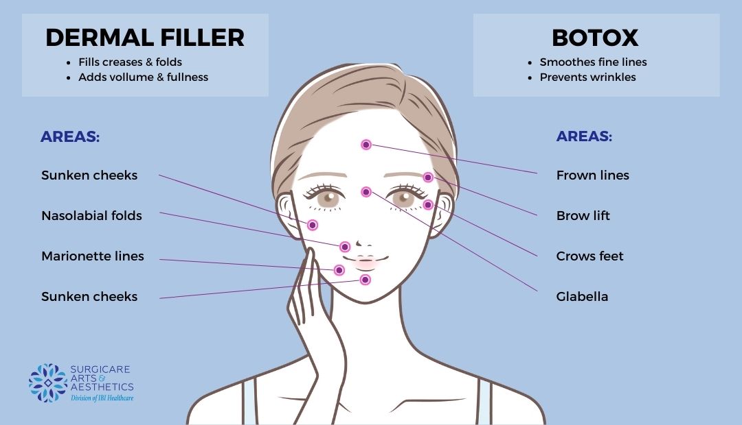 botox vs dermal filler: treatment areas