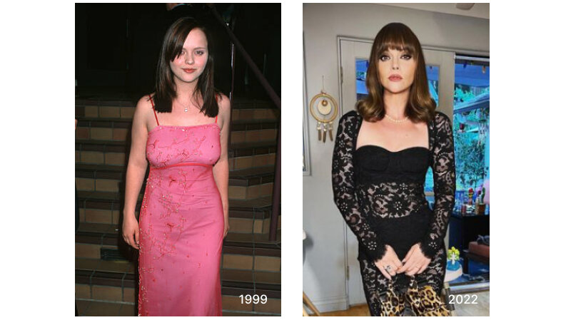 Christina Ricci before and after breast reduction surgery?