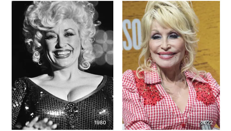 Dolly Parton before and after breast reduction